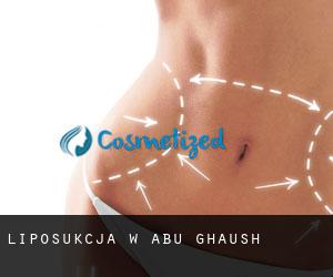 Liposukcja w Abū Ghaush