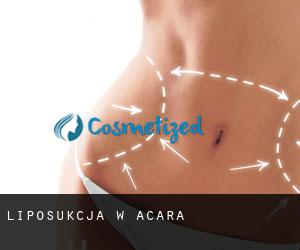 Liposukcja w Acará