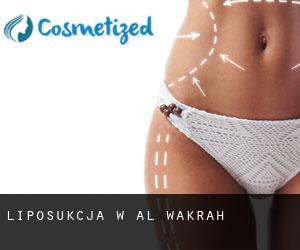 Liposukcja w Al Wakrah