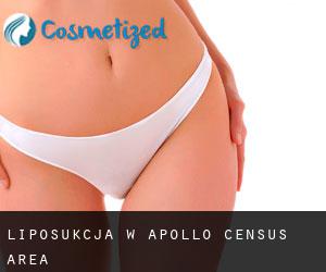Liposukcja w Apollo (census area)