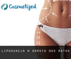 Liposukcja w Arroio dos Ratos