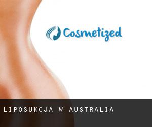 Liposukcja w Australia