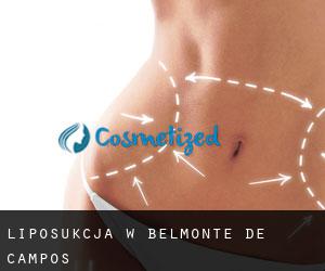Liposukcja w Belmonte de Campos