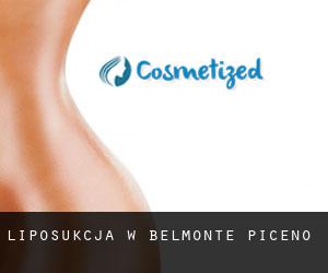 Liposukcja w Belmonte Piceno