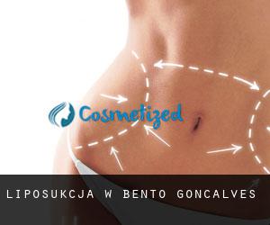 Liposukcja w Bento Gonçalves