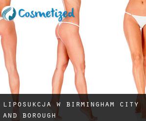 Liposukcja w Birmingham (City and Borough)