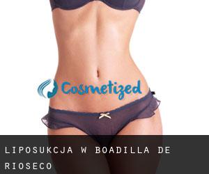 Liposukcja w Boadilla de Rioseco