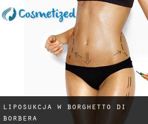 Liposukcja w Borghetto di Borbera