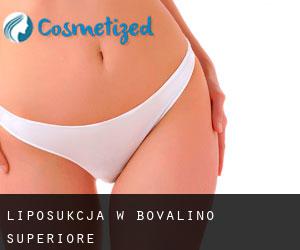 Liposukcja w Bovalino Superiore