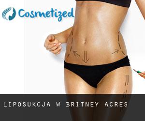 Liposukcja w Britney Acres