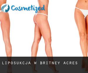 Liposukcja w Britney Acres