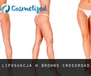 Liposukcja w Browns Crossroad