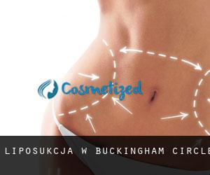 Liposukcja w Buckingham Circle