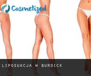 Liposukcja w Burdick
