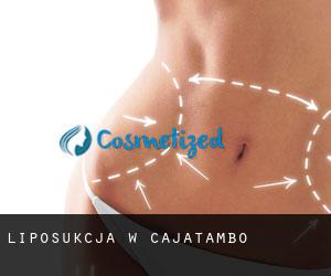 Liposukcja w Cajatambo