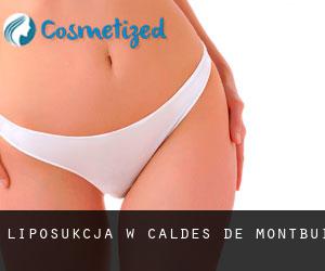 Liposukcja w Caldes de Montbui
