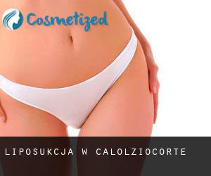 Liposukcja w Calolziocorte