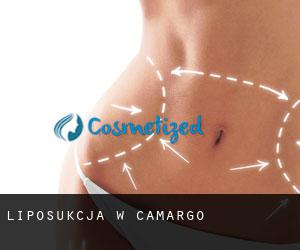 Liposukcja w Camargo