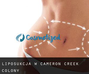 Liposukcja w Cameron Creek Colony