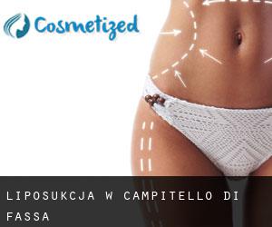 Liposukcja w Campitello di Fassa