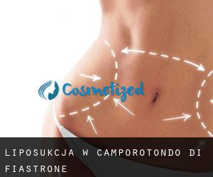 Liposukcja w Camporotondo di Fiastrone