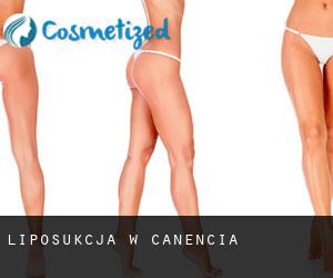Liposukcja w Canencia