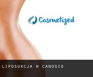 Liposukcja w Canosio