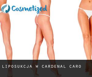 Liposukcja w Cardenal Caro