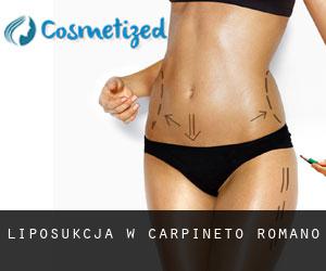 Liposukcja w Carpineto Romano