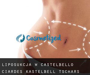 Liposukcja w Castelbello-Ciardes - Kastelbell-Tschars