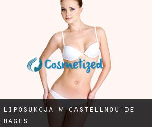 Liposukcja w Castellnou de Bages