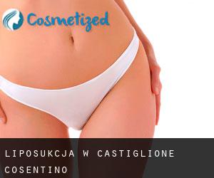 Liposukcja w Castiglione Cosentino