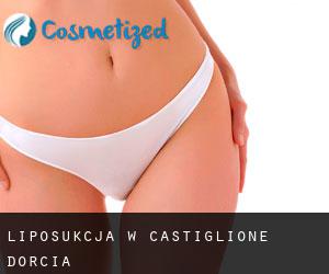 Liposukcja w Castiglione d'Orcia