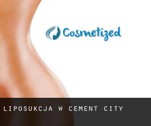 Liposukcja w Cement City