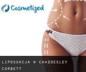 Liposukcja w Chaddesley Corbett