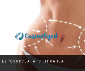Liposukcja w Chihuahua