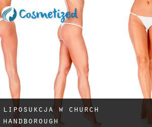 Liposukcja w Church Handborough