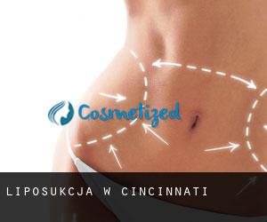 Liposukcja w Cincinnati