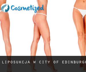 Liposukcja w City of Edinburgh