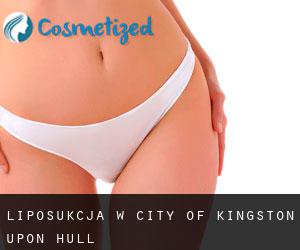 Liposukcja w City of Kingston upon Hull