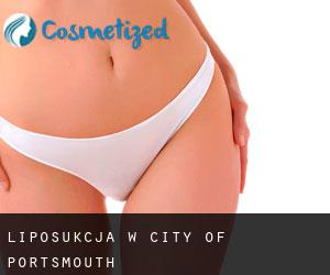 Liposukcja w City of Portsmouth