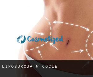 Liposukcja w Coclé