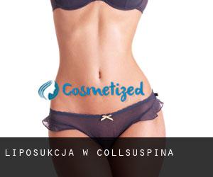 Liposukcja w Collsuspina