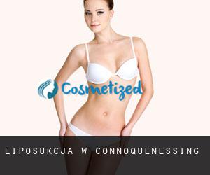 Liposukcja w Connoquenessing
