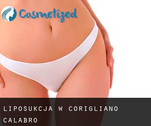 Liposukcja w Corigliano Calabro