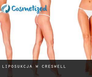 Liposukcja w Creswell