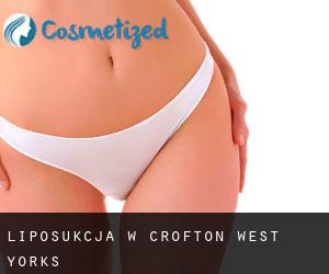 Liposukcja w Crofton West Yorks