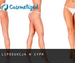 Liposukcja w Cypr