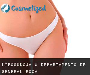Liposukcja w Departamento de General Roca