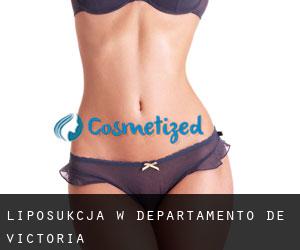 Liposukcja w Departamento de Victoria